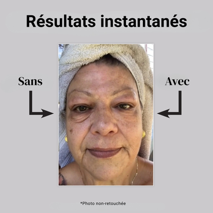 Nivela — Le correcteur de cernes instantané qui illumine le regard et lisse les signes de fatigue dès l’application.